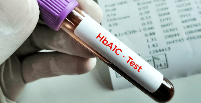 Thyrocare HbA1c Test Cost, Benefits, and Home Collection